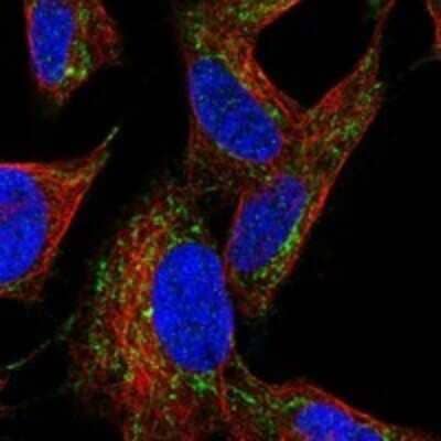 Immunocytochemistry/ Immunofluorescence: PKA 2 beta Antibody [NBP3-17753]