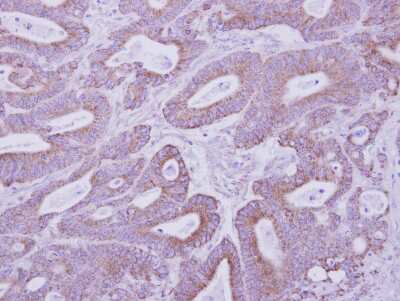 Immunohistochemistry-Paraffin: PKA 2 beta Antibody [NBP1-33773]