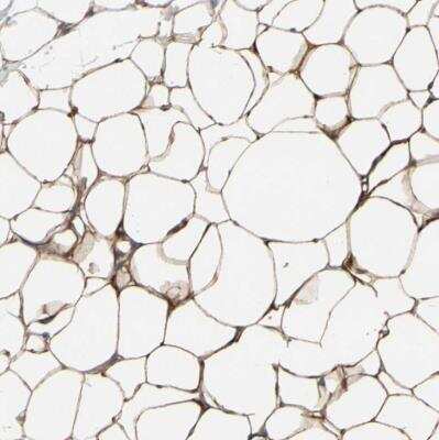 Immunohistochemistry-Paraffin: PKA 2 beta Antibody [NBP1-80879]