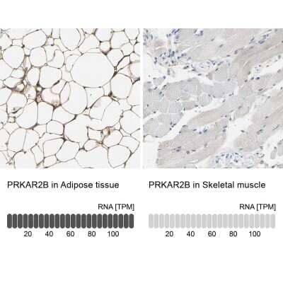 Immunohistochemistry-Paraffin: PKA 2 beta Antibody [NBP1-80879]