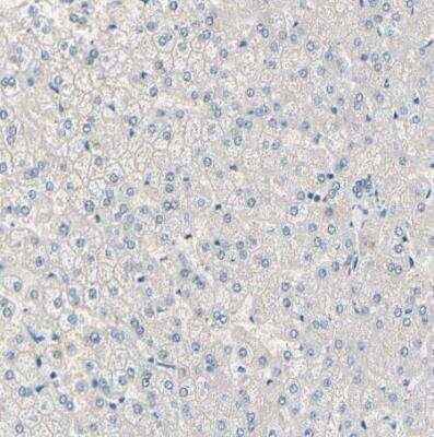 Immunohistochemistry-Paraffin: PKA 2 beta Antibody [NBP1-80879]