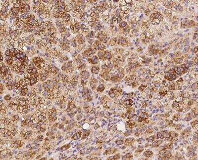 Immunohistochemistry-Paraffin: PKA 2 beta Antibody [NBP3-12636]
