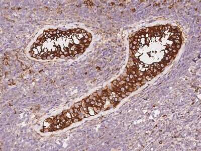 Immunohistochemistry-Paraffin: PKA 2 beta Antibody [NBP3-12636]