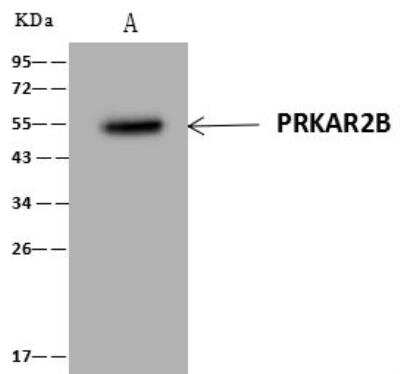 Immunoprecipitation: PKA 2 beta Antibody [NBP3-12636]
