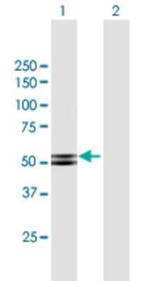 Western Blot: PKA 2 beta Antibody [H00005577-B02P]