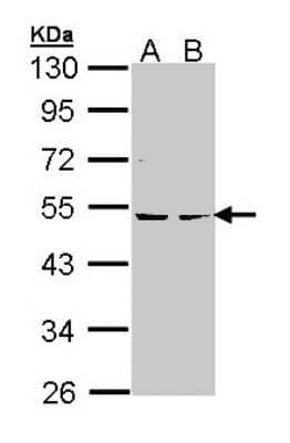 Western Blot: PKA 2 beta Antibody [NBP1-33773]