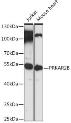 Western Blot: PKA 2 beta AntibodyAzide and BSA Free [NBP2-93226]