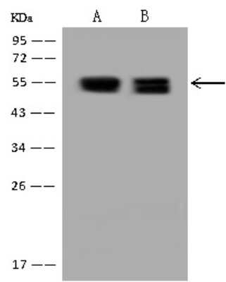 Western Blot: PKA 2 beta Antibody [NBP3-12636]