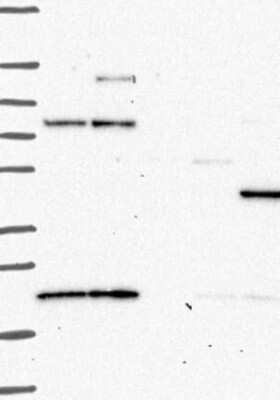 Western Blot: PKA 2 beta Antibody [NBP3-17753]