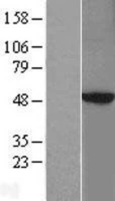 Western Blot: PKA 2 beta Overexpression Lysate [NBL1-14768]