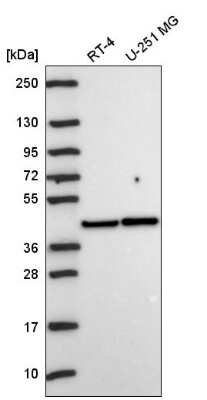 Western Blot: PKA C alpha Antibody [NBP2-57042]