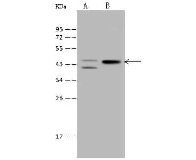 Western Blot: PKA C alpha Antibody [NBP2-99335]