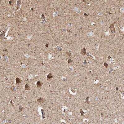 Immunohistochemistry-Paraffin: PKA C beta Antibody [NBP1-80901]