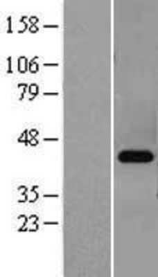 Western Blot: PKA C beta Overexpression Lysate [NBL1-14758]