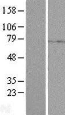 Western Blot: PKA C beta Overexpression Lysate [NBP2-04480]