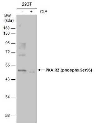 Western Blot: PKA R2 [p Ser96] Antibody [NBP3-12928]