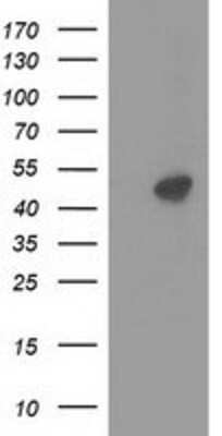 Western Blot: PKA R2 Antibody (OTI1F8) [NBP2-02520]