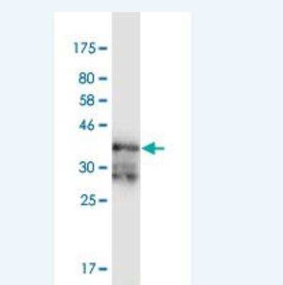 Western Blot: PKA R2 Antibody (3C7) [H00005576-M02]