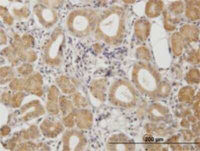 Immunohistochemistry-Paraffin: PKA R2 Antibody (6A9) [H00005576-M01]