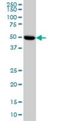 Western Blot: PKA R2 Antibody (6A9) [H00005576-M01]