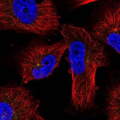 Immunocytochemistry/ Immunofluorescence: PKA R2 Antibody [NBP2-38399]