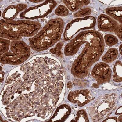 Immunohistochemistry: PKA R2 Antibody [NBP2-38399]