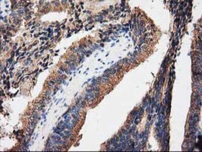 Immunohistochemistry: PKA R2 Antibody (OTI1F8) - Azide and BSA Free [NBP2-73428]