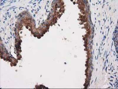 Immunohistochemistry: PKA R2 Antibody (OTI1F8) - Azide and BSA Free [NBP2-73428]