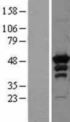 Western Blot: PKA R2 Overexpression Lysate [NBL1-14767]