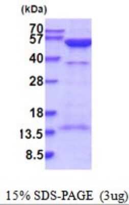 SDS-PAGE: Recombinant Human PKA R2 His Protein [NBP2-52053]