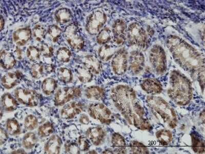 Immunohistochemistry-Paraffin: PKA RI beta Antibody (1F8) [H00005575-M05]