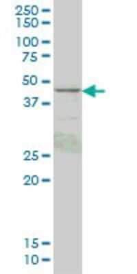 Western Blot: PKA RI beta Antibody (1F8) [H00005575-M05]