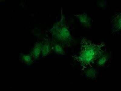 Immunocytochemistry/ Immunofluorescence: PKA RI beta Antibody (OTI2A3) - Azide and BSA Free [NBP2-73430]