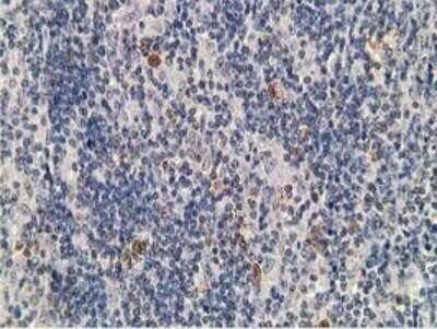 Immunohistochemistry: PKA RI beta Antibody (OTI2A3) - Azide and BSA Free [NBP2-73430]