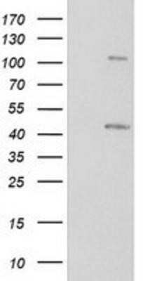 Western Blot: PKA RI beta Antibody (OTI2A3)Azide and BSA Free [NBP2-73430]