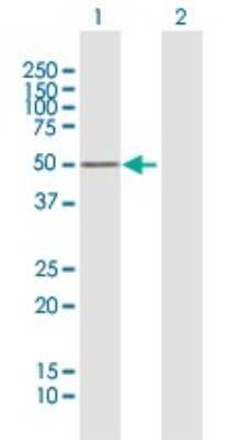 Western Blot: PKA RI beta Antibody [H00005575-B01P]