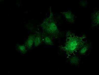 Immunocytochemistry/ Immunofluorescence: PKA RI beta Antibody (OTI2A3) [NBP2-00634]