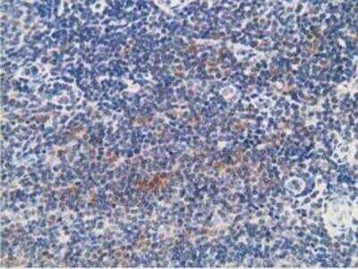 Immunohistochemistry-Paraffin: PKA RI beta Antibody (OTI2A3) [NBP2-00634]