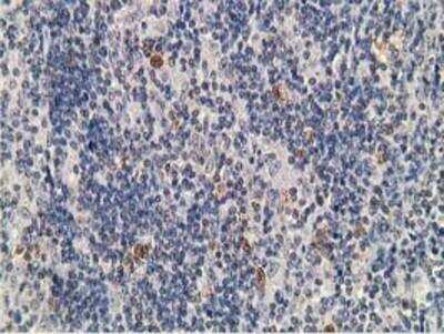Immunohistochemistry-Paraffin: PKA RI beta Antibody (OTI2A3) [NBP2-00634]