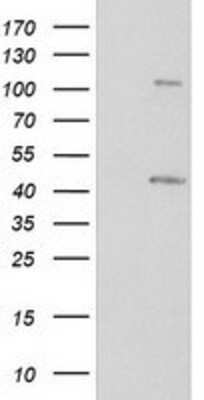 Western Blot: PKA RI beta Antibody (OTI2A3) [NBP2-00634]