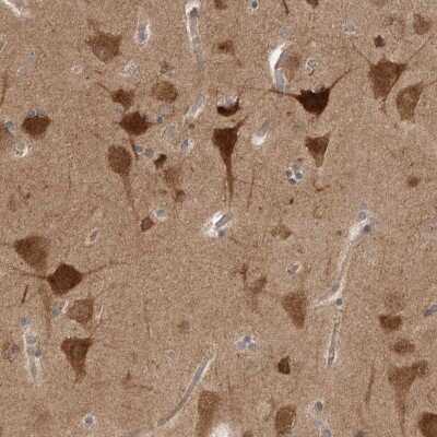 Immunohistochemistry-Paraffin: PKA RI beta Antibody [NBP1-87451]