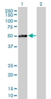 Western Blot: PKA RI beta Antibody [H00005575-D01P]