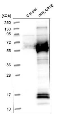 Western Blot: PKA RI beta Antibody [NBP1-87451]