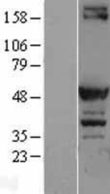 Western Blot: PKA RI beta Overexpression Lysate [NBL1-14766]