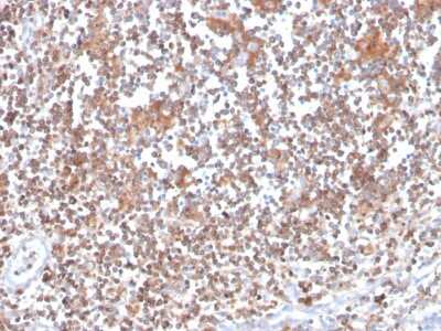 Immunohistochemistry-Paraffin: PKC alpha Antibody (133) [NBP3-07334]