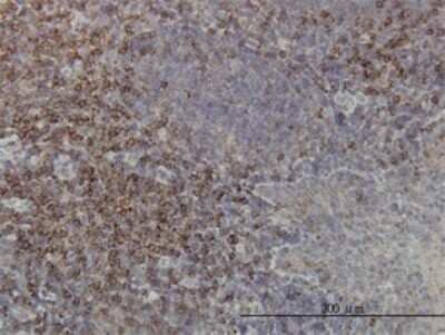 Immunohistochemistry-Paraffin: PKC alpha Antibody (2F11) [H00005578-M01]