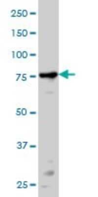 Western Blot: PKC alpha Antibody (2F11) [H00005578-M01]