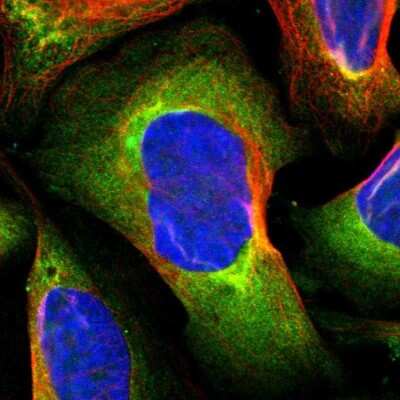 Immunocytochemistry/ Immunofluorescence: PKC alpha Antibody [NBP1-87269]