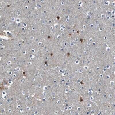 Immunohistochemistry-Paraffin: PKC alpha Antibody [NBP1-87268]