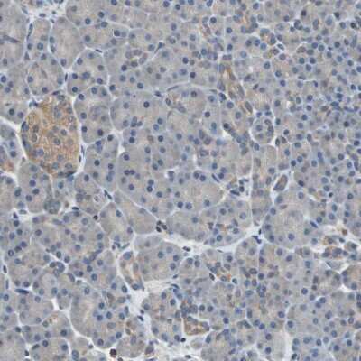 Immunohistochemistry-Paraffin: PKC alpha Antibody [NBP1-87268]